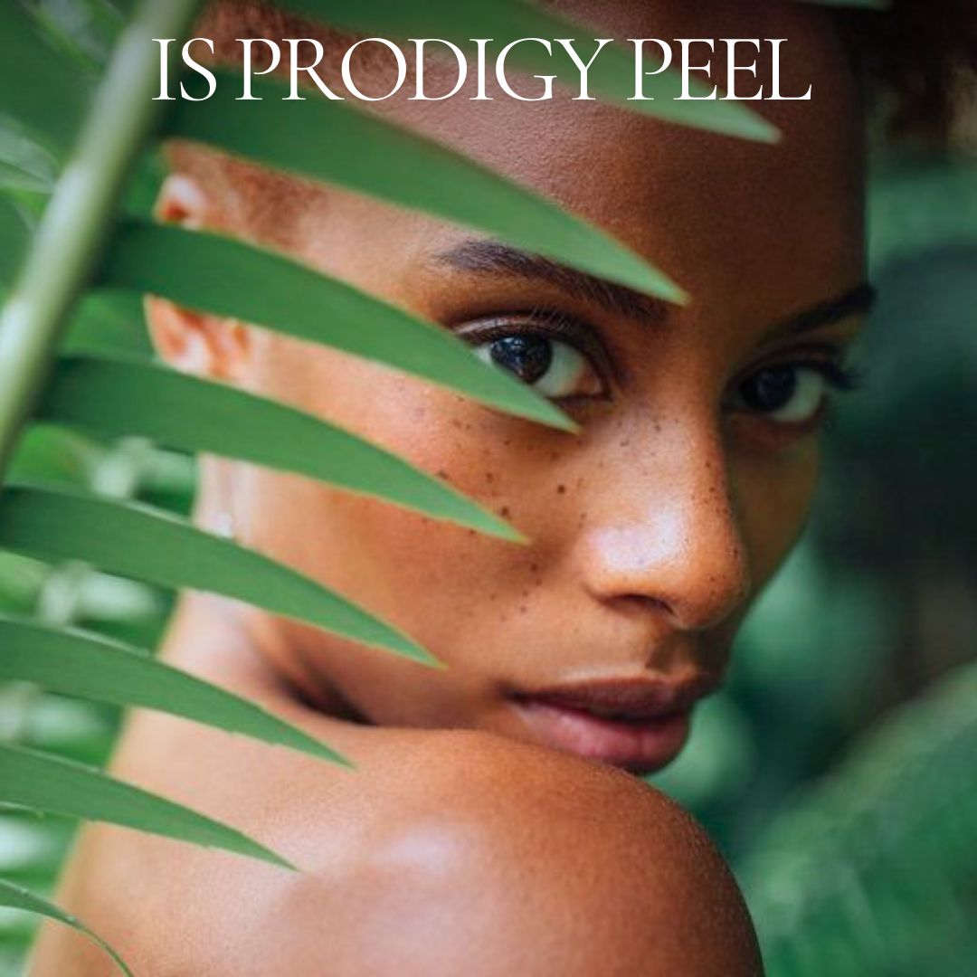 IS Prodigy Peel.
